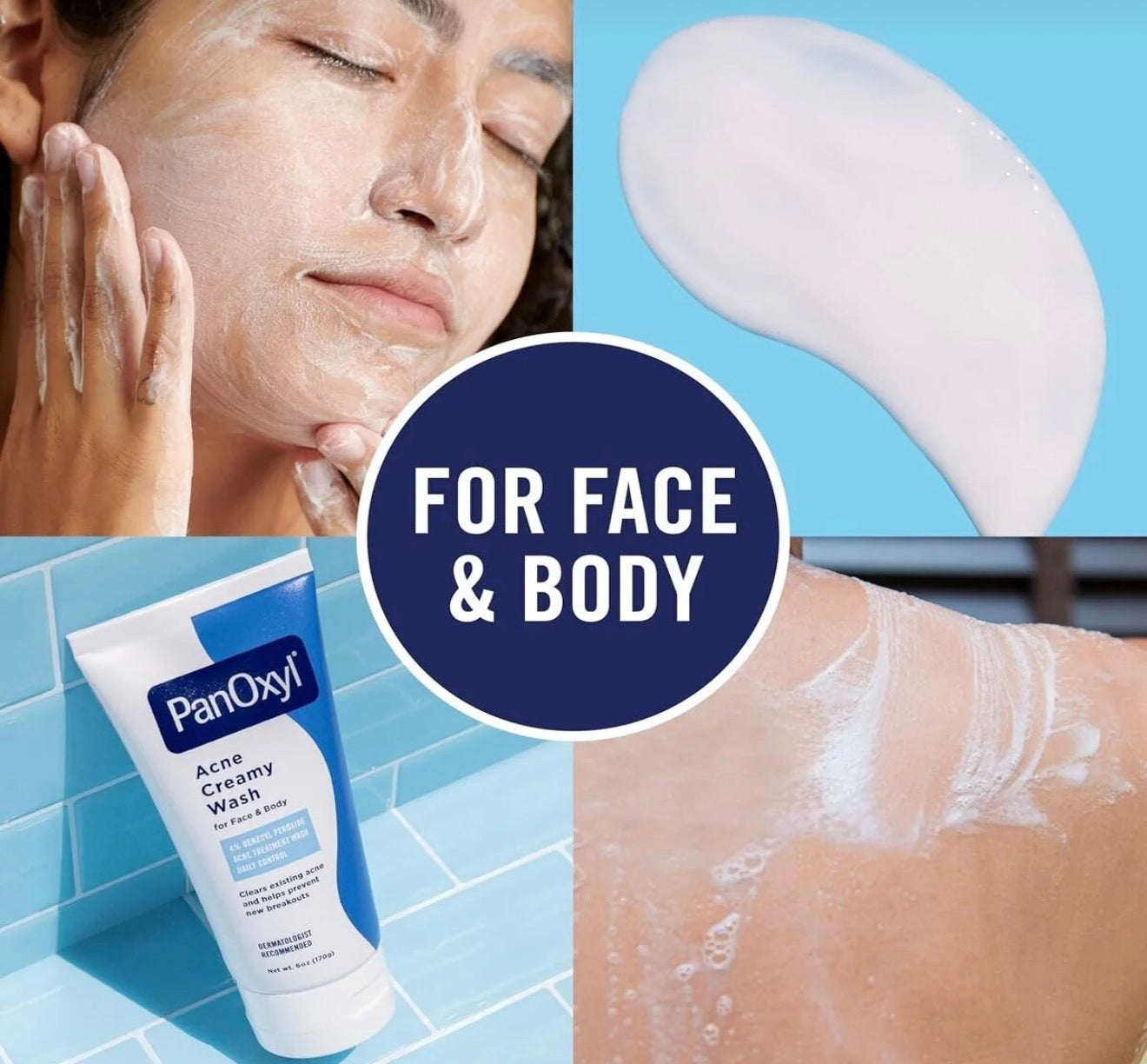 PanOxyl Acne Creamy Face & Body Wash 170g