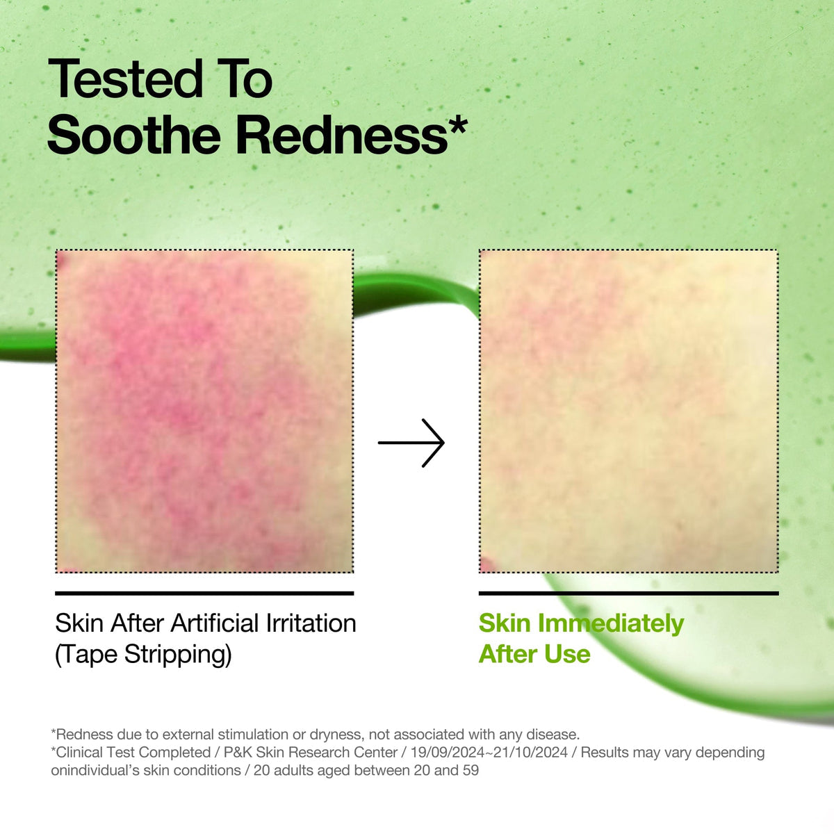 Anua Azelaic Acid 10 Hyaluron Redness Soothing Serum 30 ml